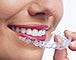 Orthodontie / Zahnspangen